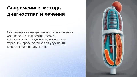 Современные подходы к диагностике и лечению панкреатита