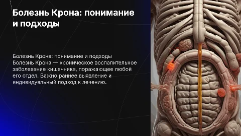 Болезнь Крона