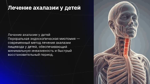 Пероральная эндоскопическая миотомия для лечения ахалазии