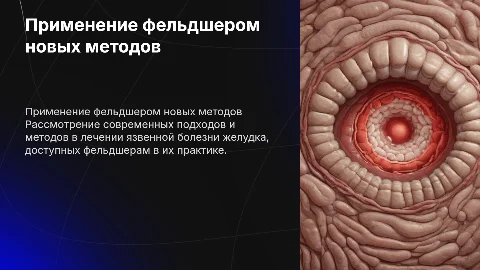 Презентация о применении методов фельдшера при язвенной болезни