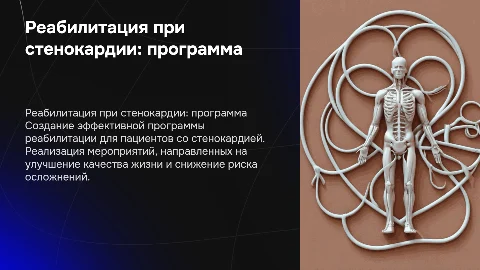 Создание программы реабилитационных мероприятий для стенокардии