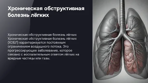 Хроническая обструктивная болезнь лёгких