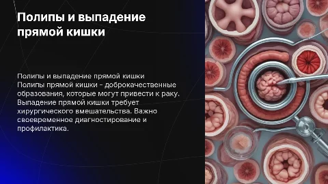 Полипы и выпадение прямой кишки: диагностика и лечение