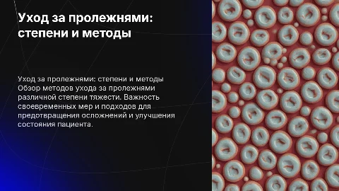 Уход за пролежнями различной степени тяжести