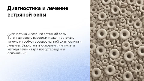 ДИАГНОСТИКА И ЛЕЧЕНИЕ ВЕТРЯНОЙ ОСПЫ У ВЗРОСЛЫХ
