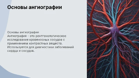 Ангиография