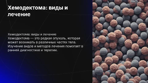 Хемодектома: виды и лечение редких опухолей