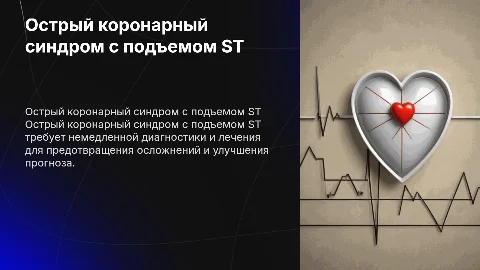 Острый коронарный синдром с подъемом ST: диагностика и лечение