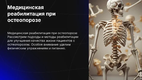 Медицинская реабилитация при остеопорозе