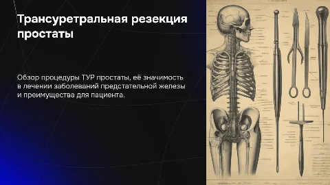 Трансуретральная резекция простаты