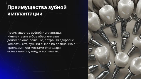 Преимущества имплантации зубов перед другими способами