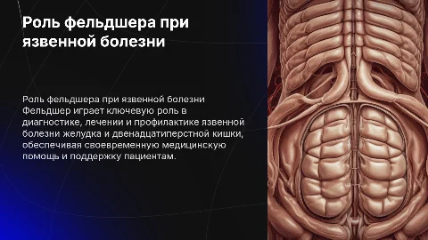 Деятельность фельдшера при язвенной болезни желудка