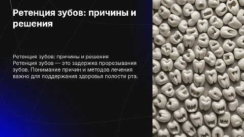 ретенция зубов
