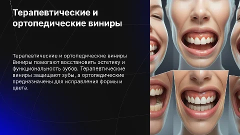 терапевтические и ортопедические виниры