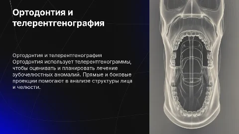 ортодонтия, телерентгенограмма прямой и боковой проекции
