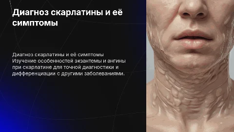 Дифференциальный диагноз скарлатины по экзантеме и ангине