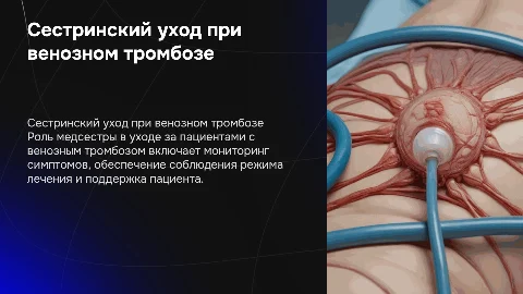 Сестринский уход за пациентами с венозным тромбозом
