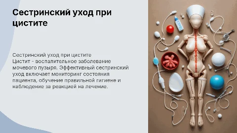 Презентация по теме сестринский уход за больными с циститом