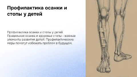 Презентация для родителей: профилактика нарушений осанки у детей