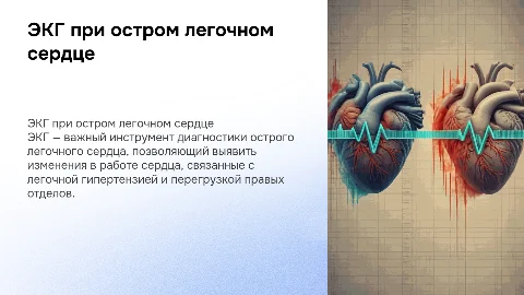 ЭКГ при остром легочном сердце