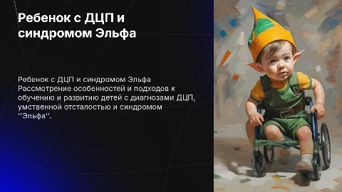 Ребенок с ДЦП и Умственной отсталость и синдромом "Эльфа"