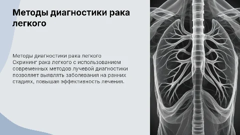 Скрининг рака легкого: методы лучевой диагностики
