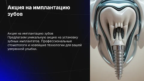 АКЦИЯ ПО ИМПЛАНТАЦИИ ЗУБОВ