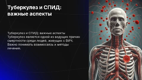 Туберкулез у людей, болеющих спидом