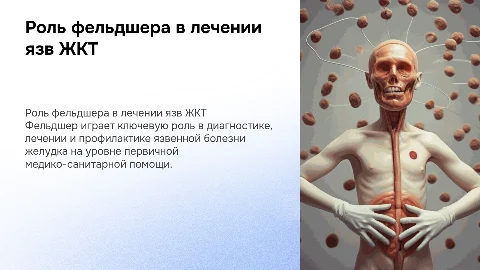 Деятельность фельдшера в лечении язвенной болезни желудка
