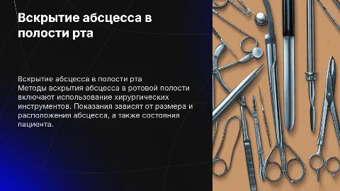 Методы и показания вскрытия абцесса в полости рта
