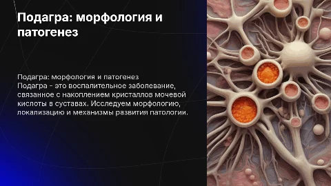 Подагра морфология, локализация и патогенез