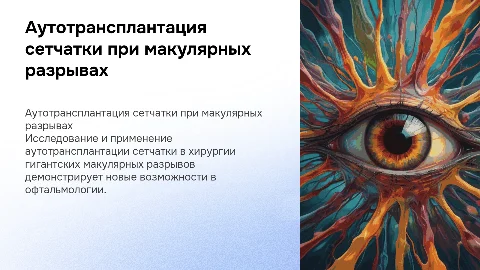 Аутотрансплантация сетчатки в хирургии макулярных разрывов