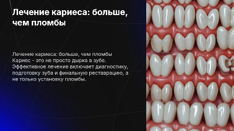 Вылечить кариес это не поставить пломбу. Этапы лечения
