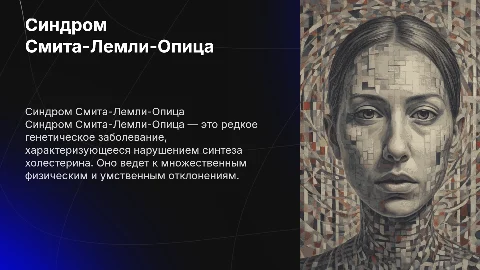 Синдром Смита-Лемли-Опица