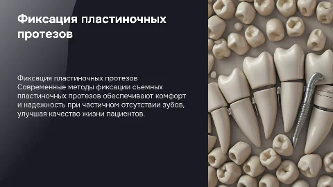 Способы фиксации съемных пластиночных протезов