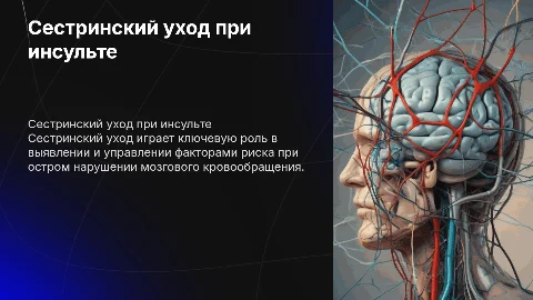 Сестринский уход при остром нарушении мозгового кровообращения