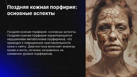 Поздняя кожная порфирия: диагностика и лечение