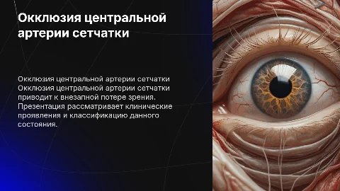 Окклюзия центральной артерии сетчатки: клиника и классификация