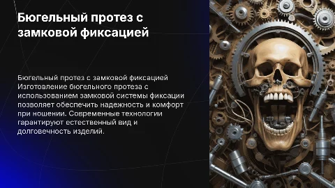 Изготовление бюгельного протеза с замковой системой фиксации