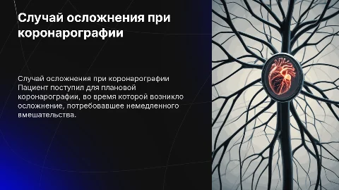 Клинический случай осложнения при коронарографии