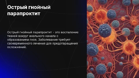 Острый гнойный парапроктит
