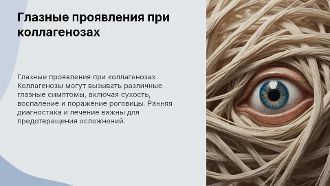 глазные проявления при коллагенозах