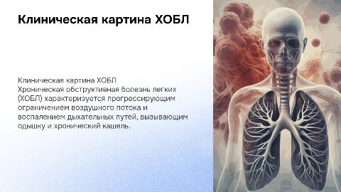 хобл клиническая картина