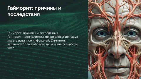Заболевание Гайморит