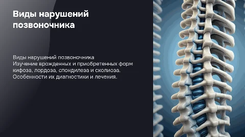 Врожденный и приобретенный кифозы, Лордоз Спондилез , Сколиоз
