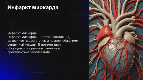 Презентация на английском о инфаркте миокарда