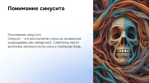 Синусит