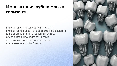 имплантация зубов