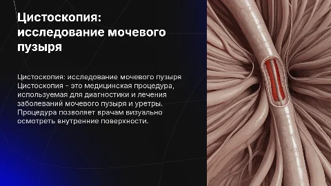 цистоскопия