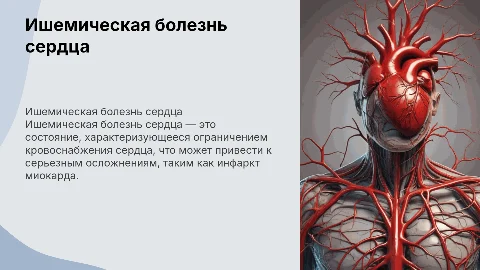 ишемическая болезнь медицина